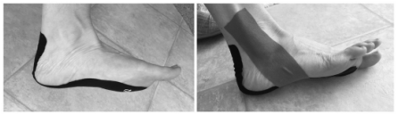 Using KT tape as a remedy for plantar fasciitis - keep moving mama
